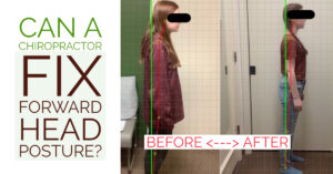 can you correct head forward posture